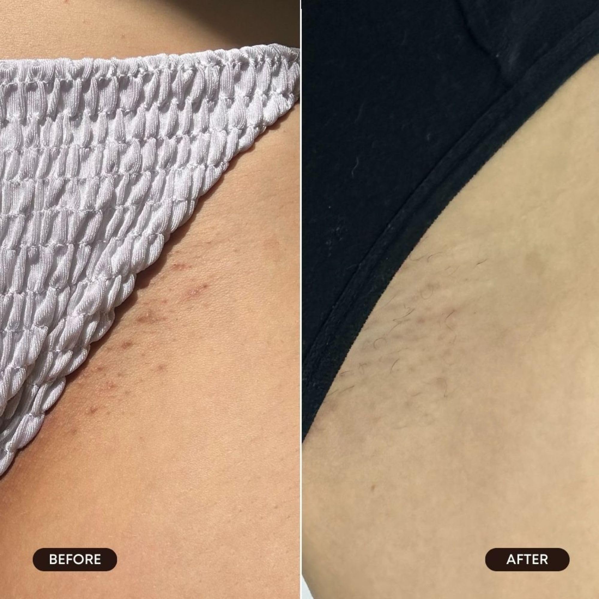 Bushbalm Roller Rescue bottle close-up highlights fragrance-free pH balanced design.