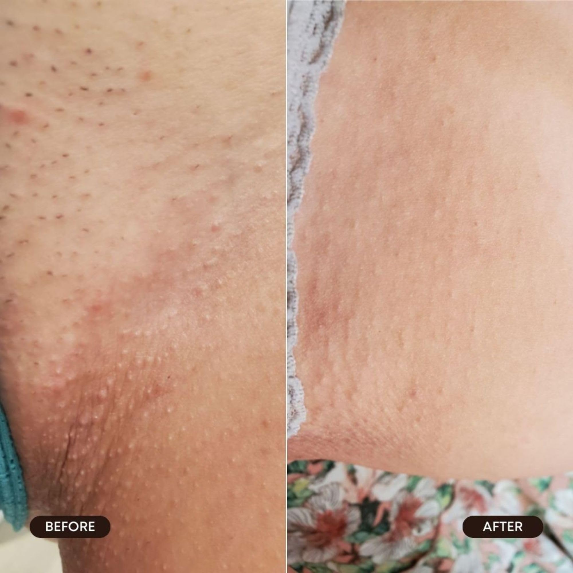 Bushbalm Roller Rescue vegan cruelty-free label signals clean skincare.