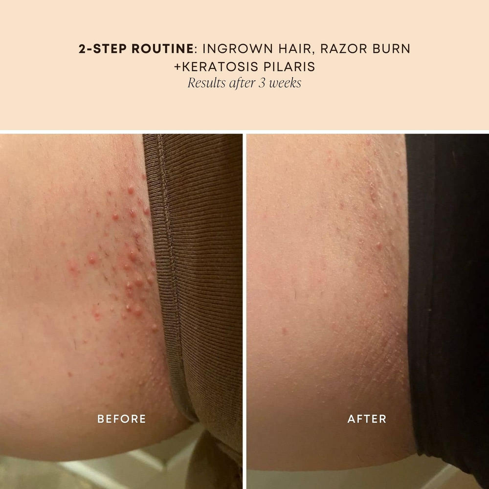 Bushbalm Sweet Escape Oil on body skin offers a hydrating routine.