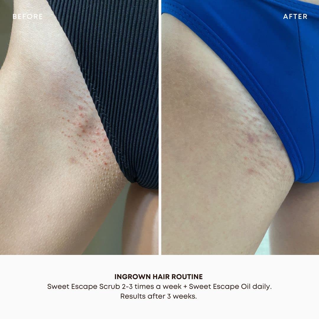 Bushbalm Sweet Escape oil dropper conveys calming, hydrating post-removal care.