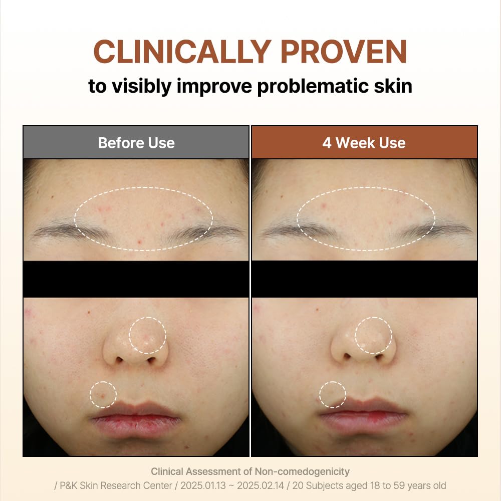 BY WISHTREND Mandelic Acid 5% Skin Prep Water in a morning routine scene signals gentle skin prep
