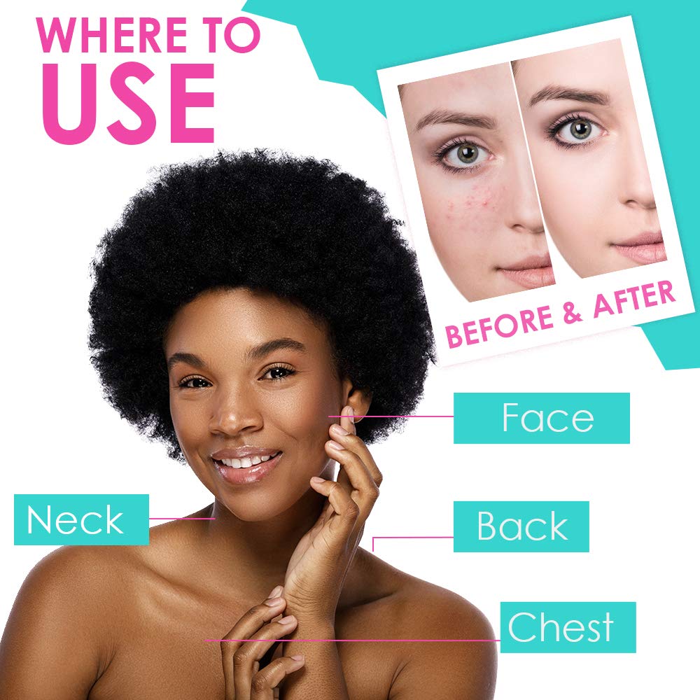Bye Bye Blemish label highlights salicylic acid and zinc oxide ingredients