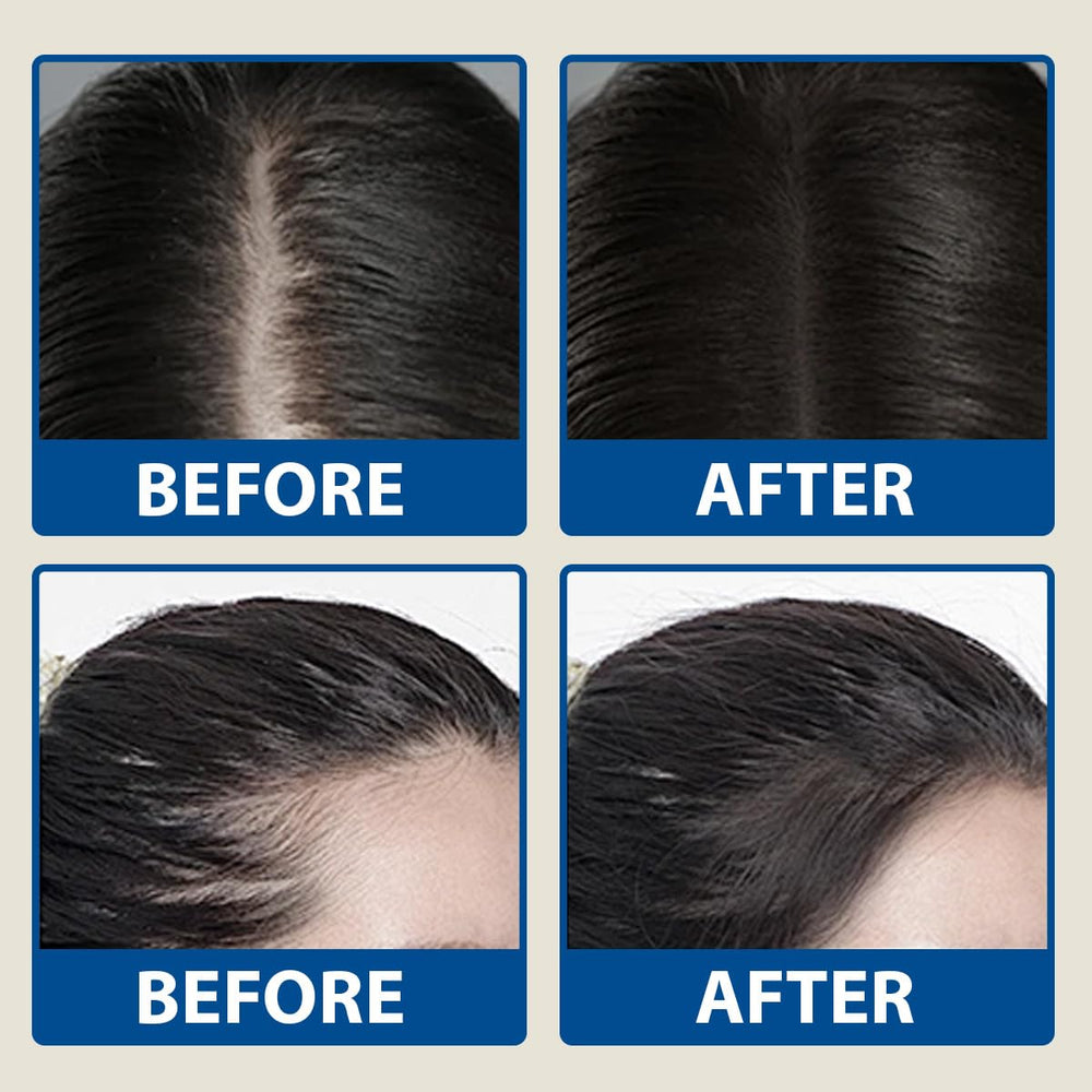 BYXE redensyl-anagain ingredients bottle highlights two clinically studied components for hair support.