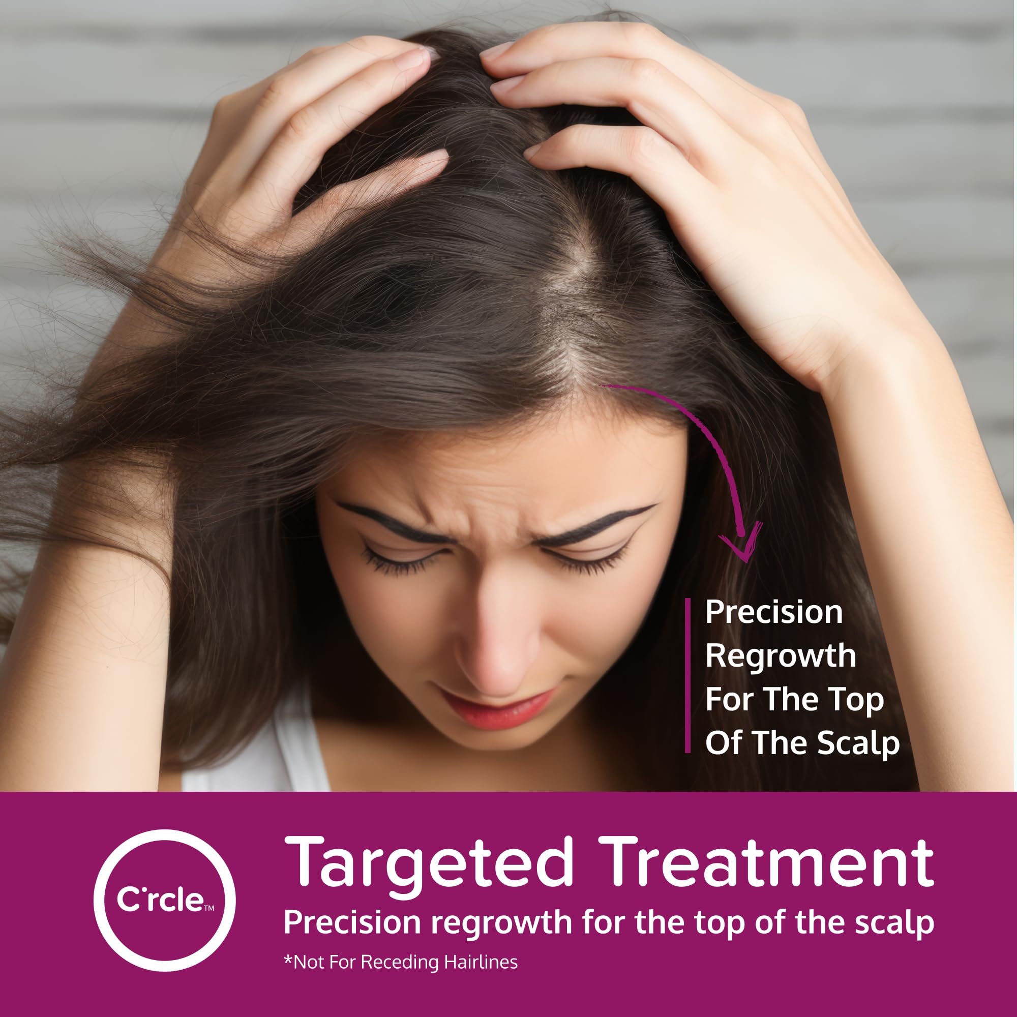 C'rcle Minoxidil foam on hair regrowth closeup suggests a fuller appearance.