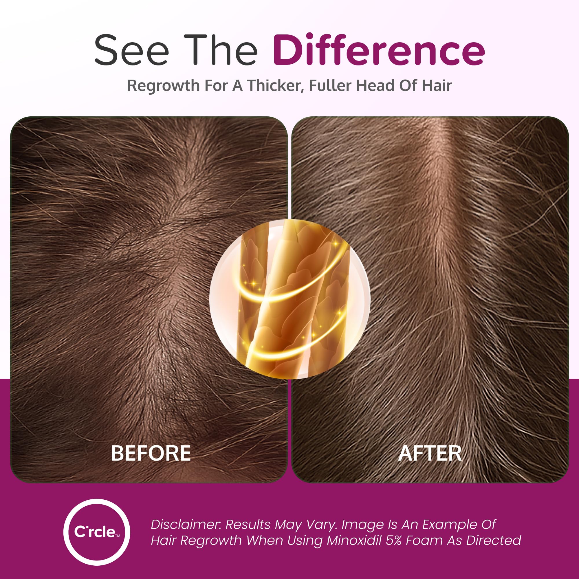 C'rcle Minoxidil foam on scalp application demonstrates quick-drying comfort.
