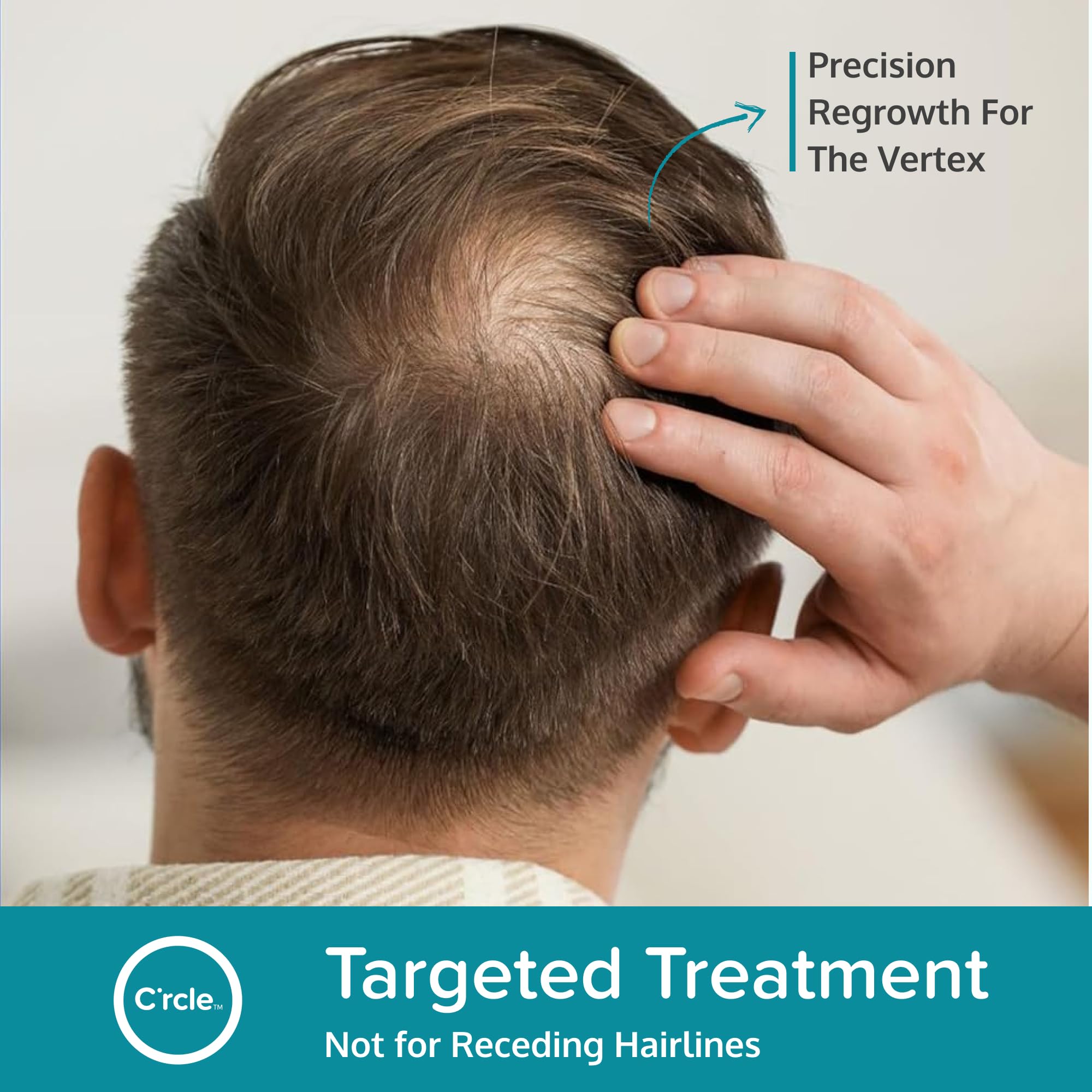 C'rcle minoxidil foam 5% application — targeted thinning area care.