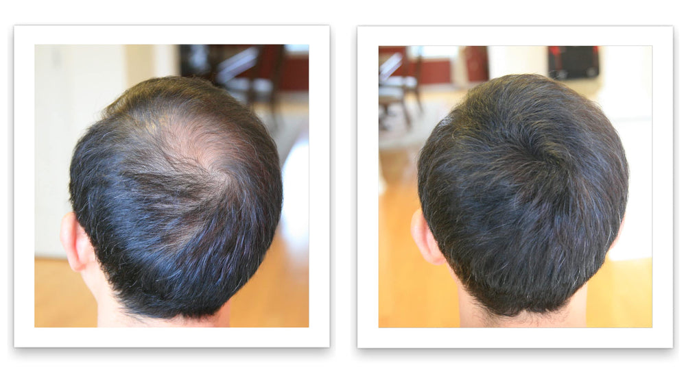 Caboki easy-to-use shake and pat application method.