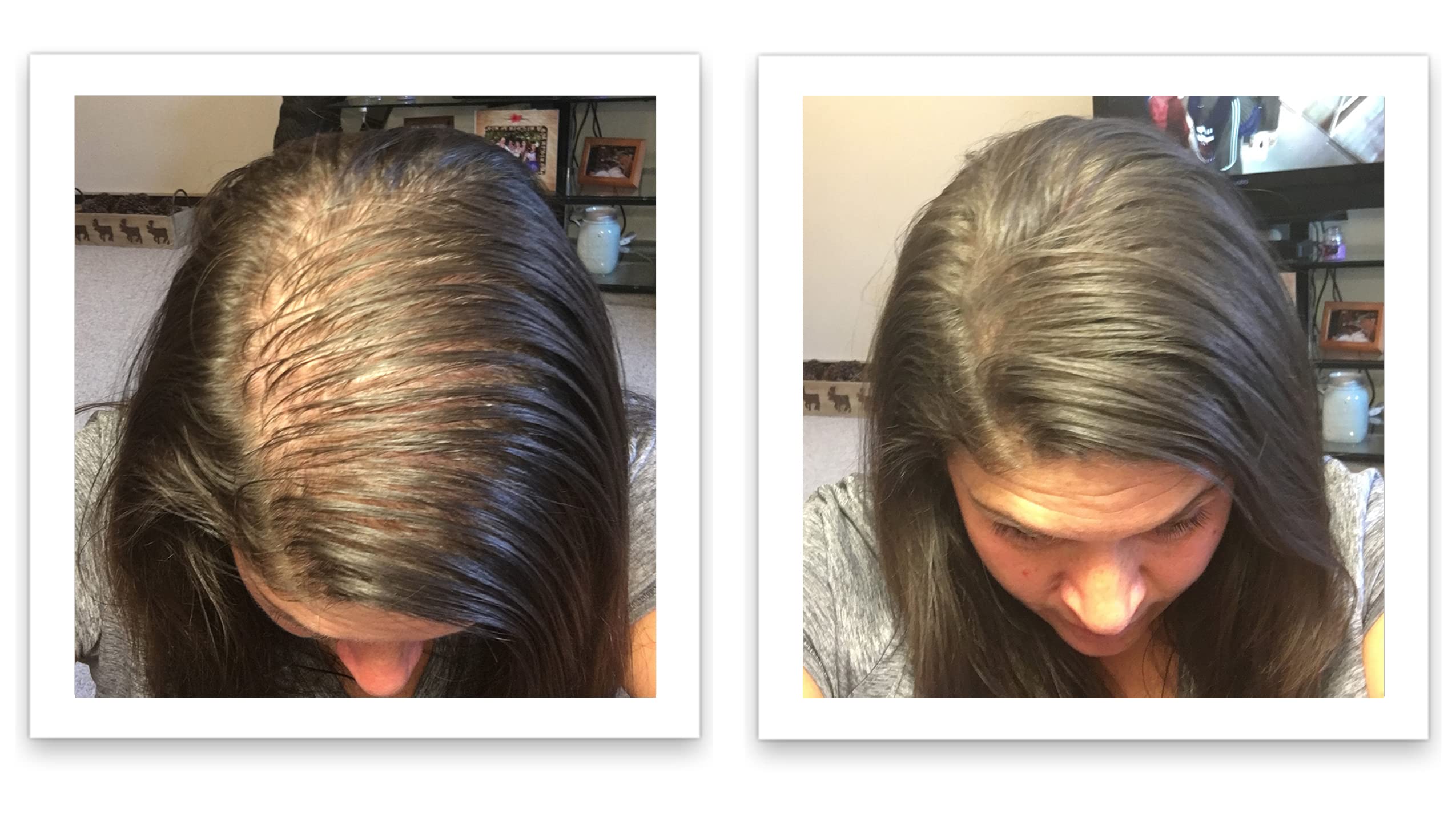After application, Caboki Dark Brown creates a natural density along the part.