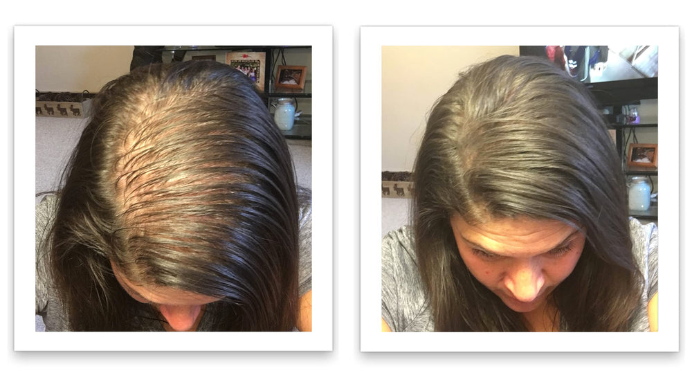 After application, Caboki Dark Brown creates a natural density along the part.