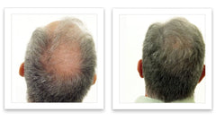 Caboki part-line-coverage highlights wider look for thinning hair instantly