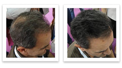 Caboki thinning hair fuller look demonstrates dramatic visual enhancement.