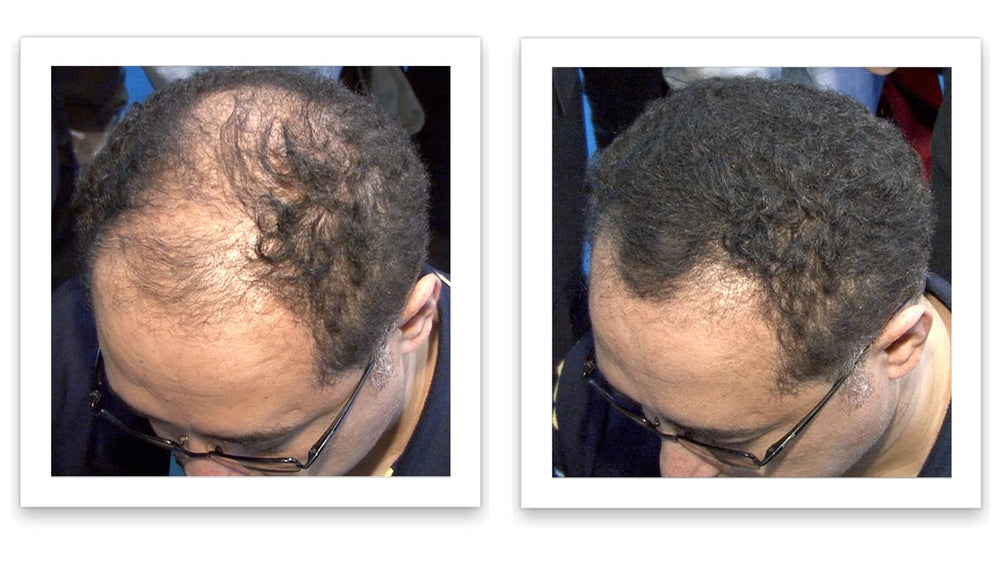 Caboki widening hair part effect for a fuller silhouette.
