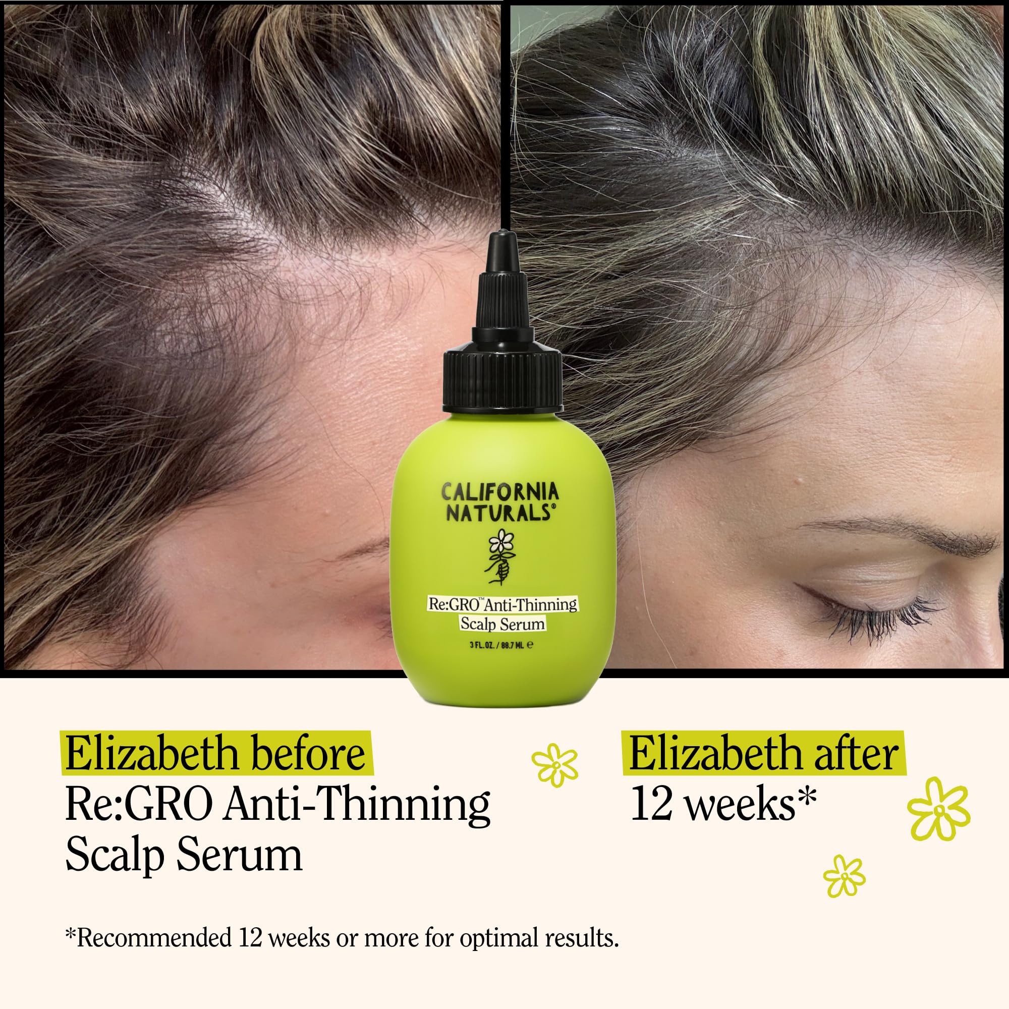 Applying Re:GRO serum on the scalp targets thinning areas