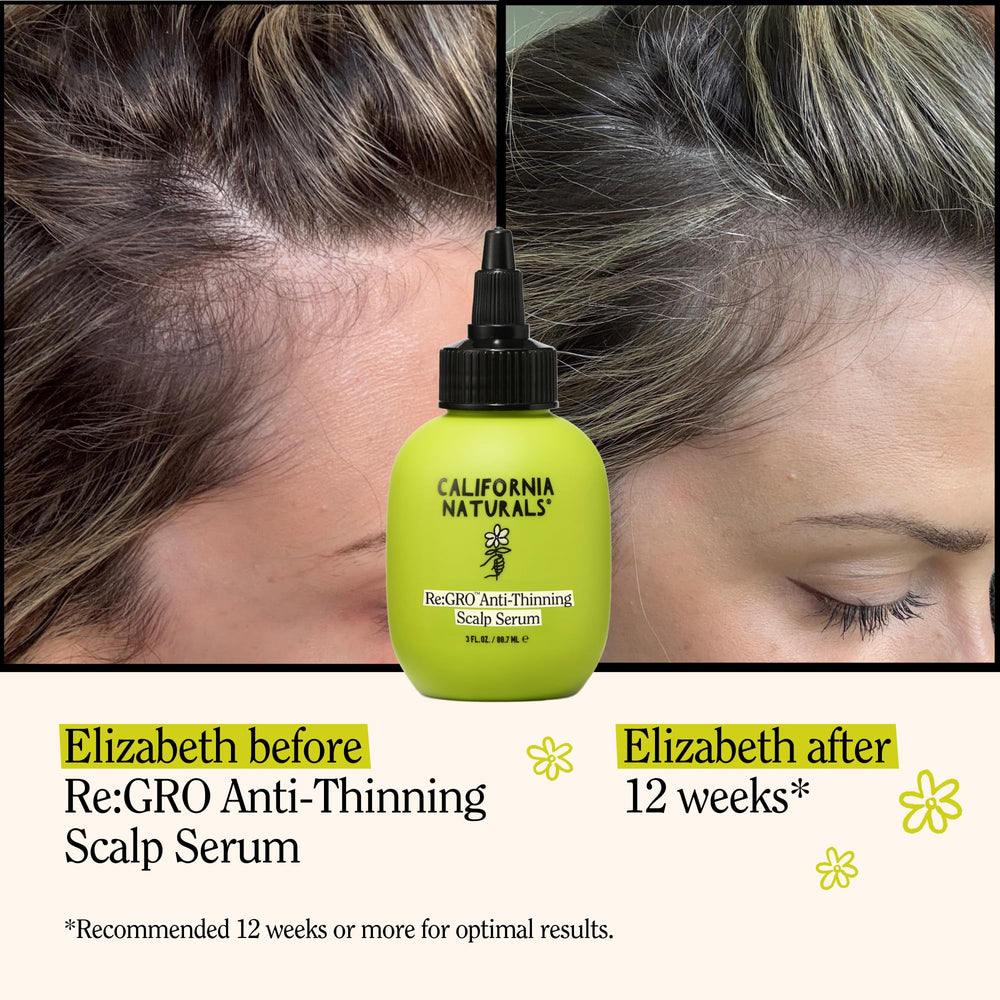 Applying Re:GRO serum on the scalp targets thinning areas