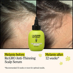 Closeup label emphasizes 5% Capixyl and natural ingredients