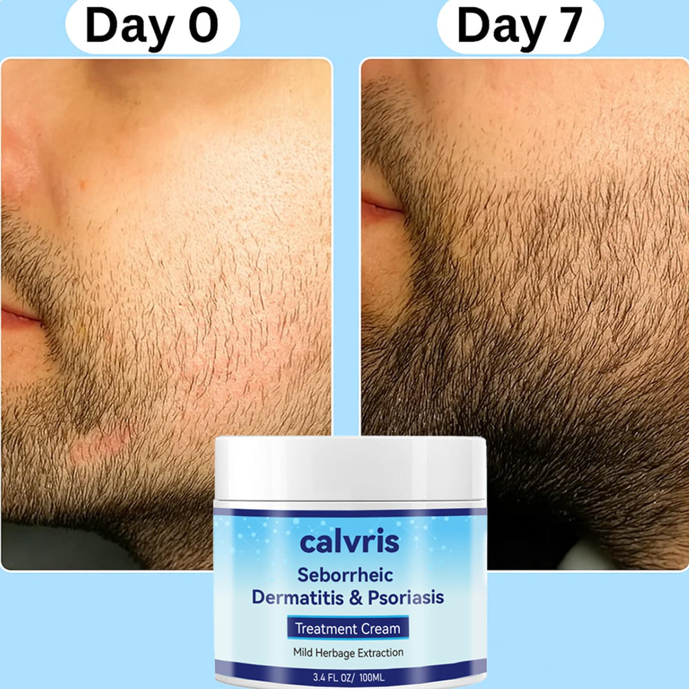 Calvris Scalp Comfort Balm applying scene demonstrates cooling sensation