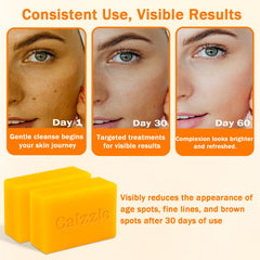 Calzzle Kojic Acid Soap 4-pack with net and holder promotes tidy, gentle cleansing