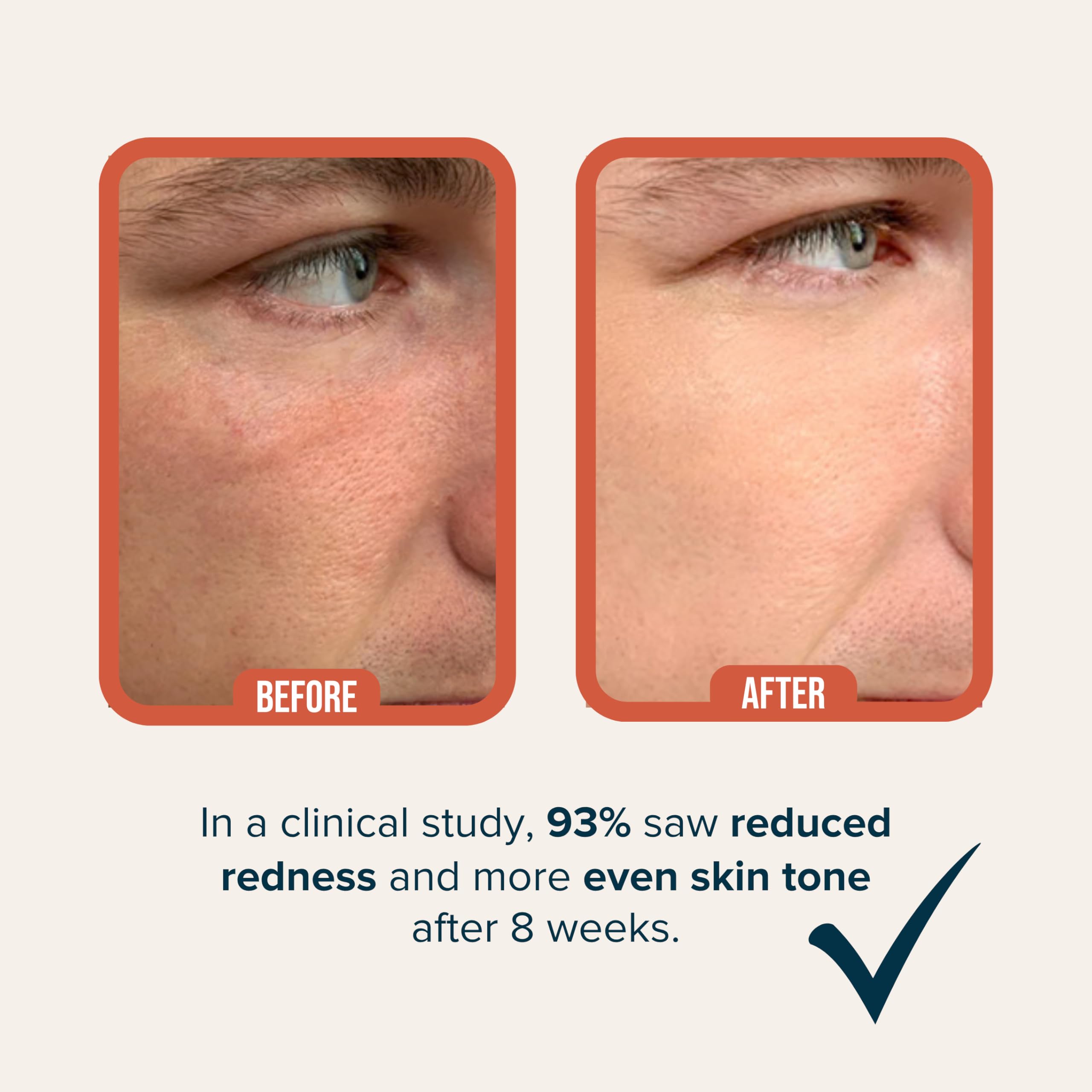 Cardon plant-based ingredients like niacinamide support skin tone