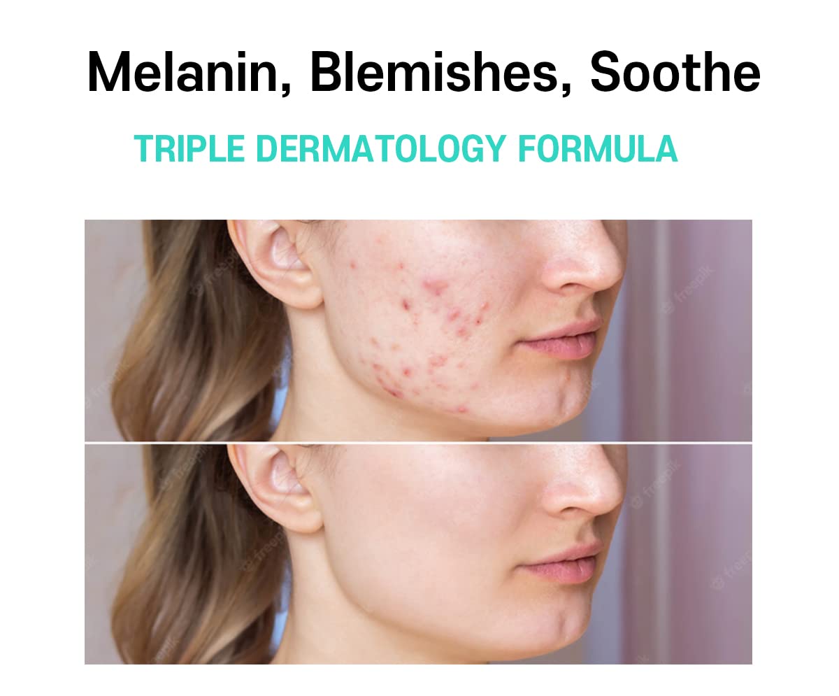 CARE:NEL Tranexamic Acid pack shows dark-spot-targeted formula for more even-toned appearance