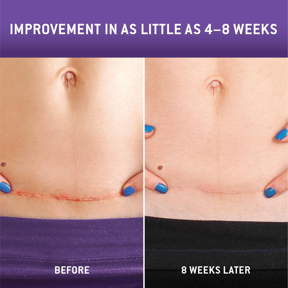 Care Science closeup reveals soft medical-grade silicone texture for comfortable daily wear