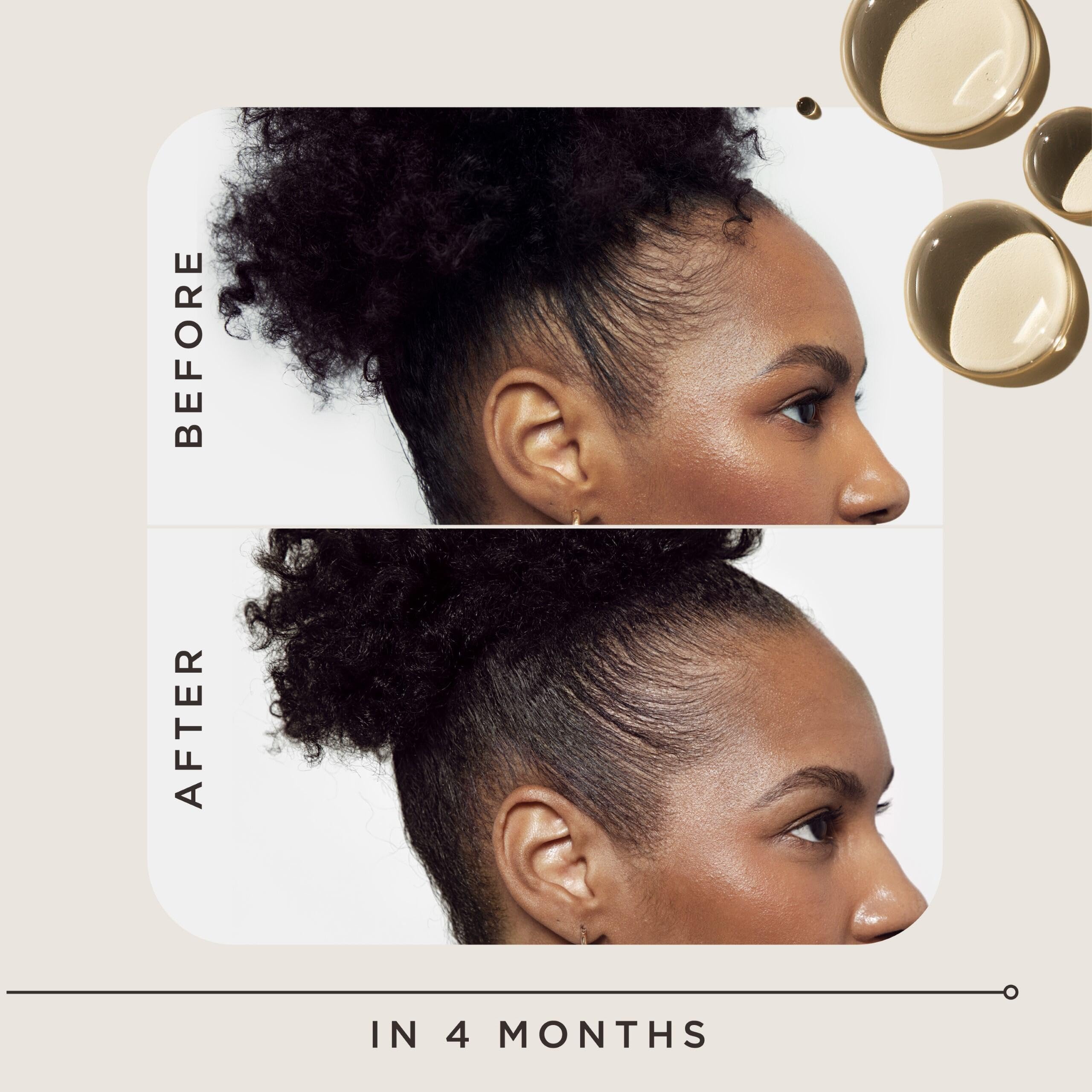 Carol's Daughter Goddess Strength scalp area showing thinning and focus.