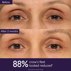 Caudalie Premier Cru eye cream swatch showing hydration and luminosity near eye.