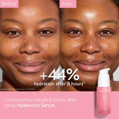 Caudalie VinoHydra serum dropper close-up highlighting smooth absorption.