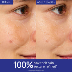Fingers apply Caudalie Vinoperfect Essence as the first skincare step, prepping skin