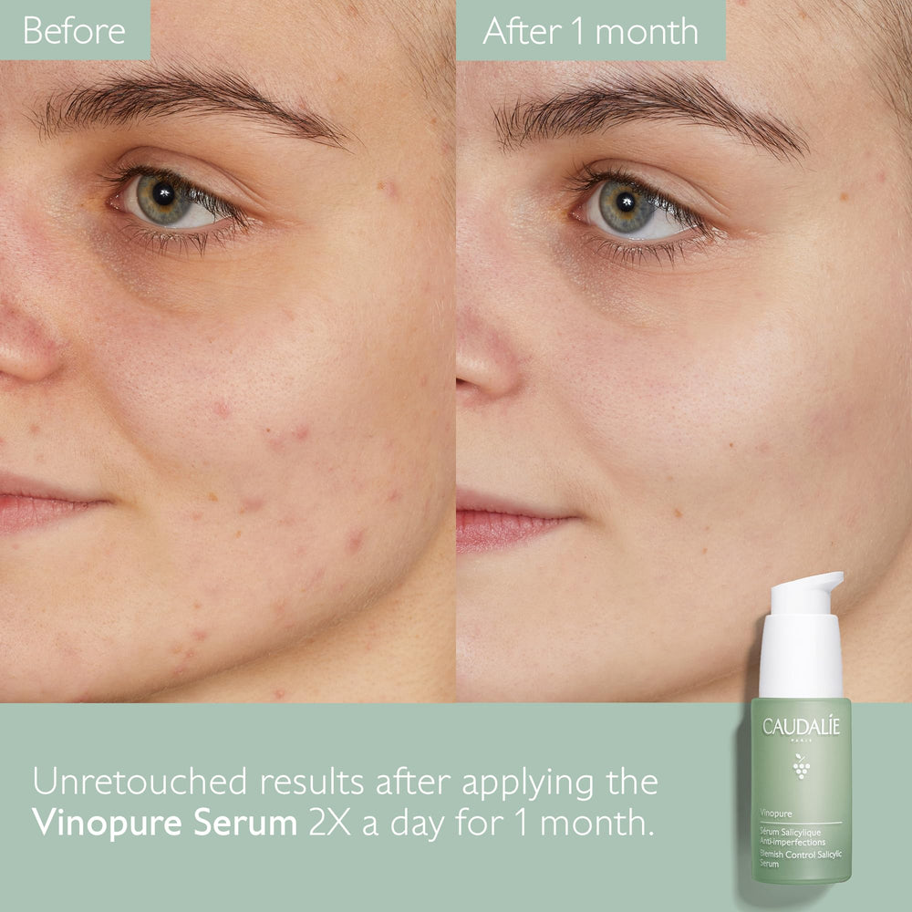 Caudalie Vinopure evening application showing step in night skincare.