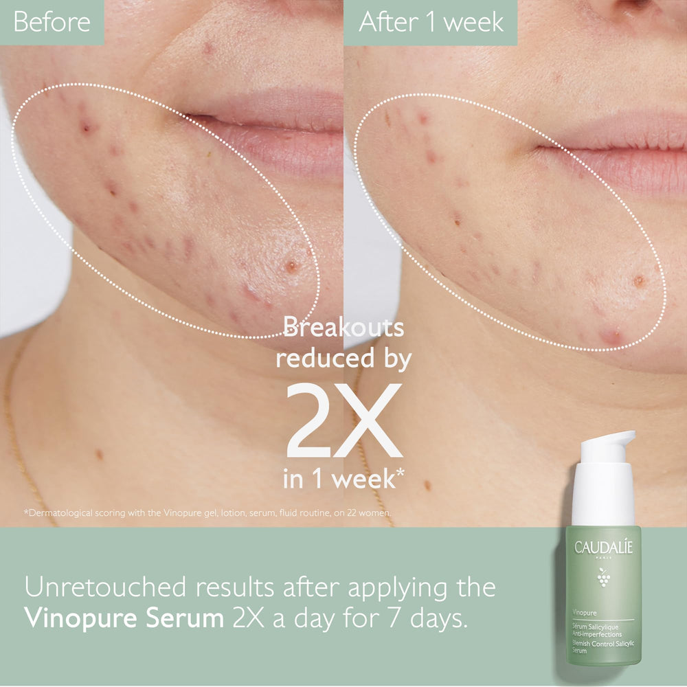 Caudalie Vinopure niacinamide ingredient shot emphasizing brightening and texture.