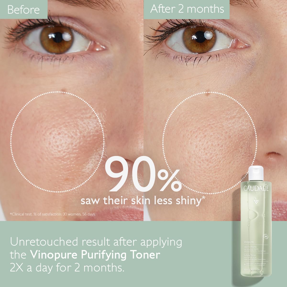 Caudalie Vinopure toner applied with cotton pad to minimize pores.