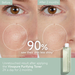 Caudalie Vinopure toner applied with cotton pad to minimize pores.