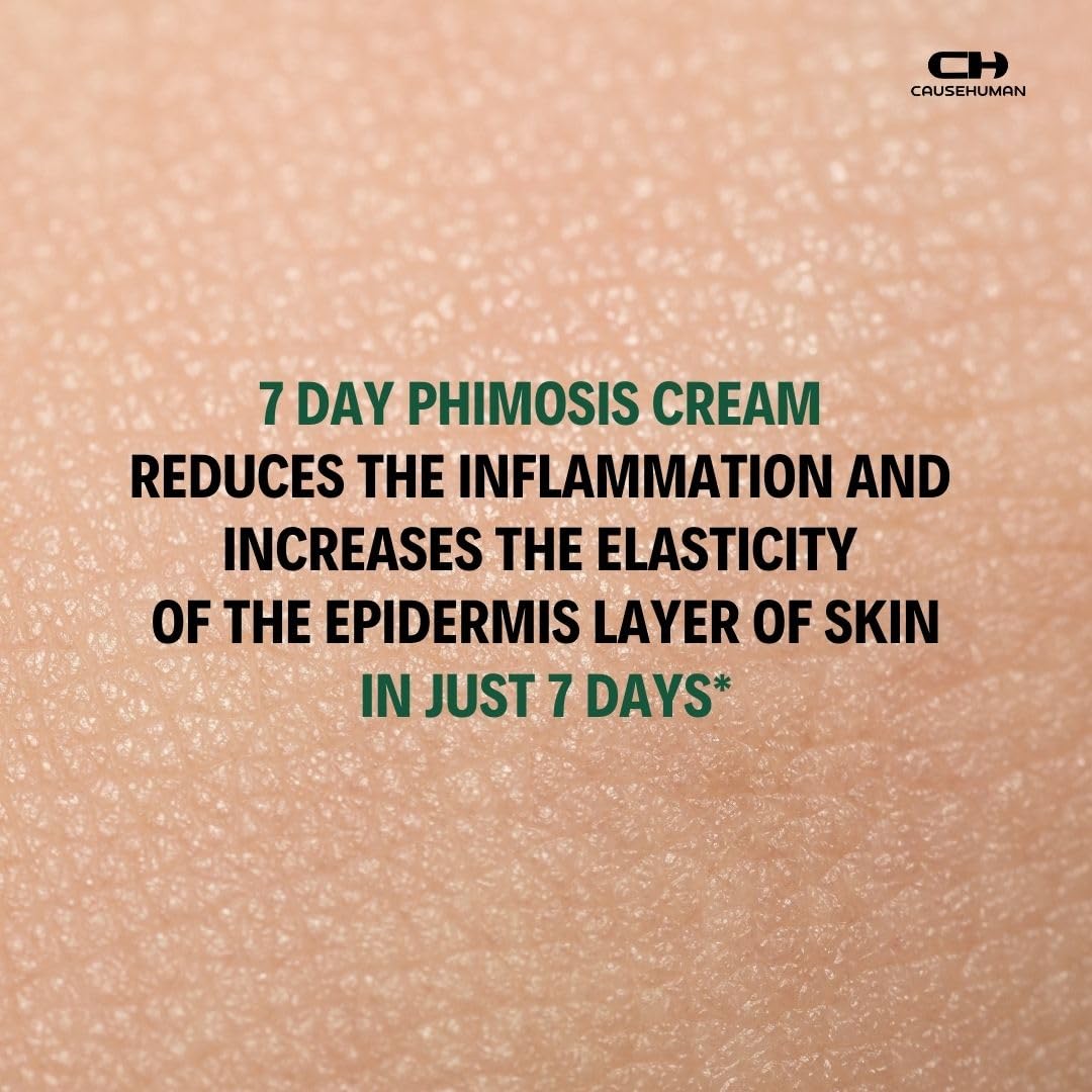 Cause Human 7-Day Phimosis Cream being applied for comfortable daily relief.