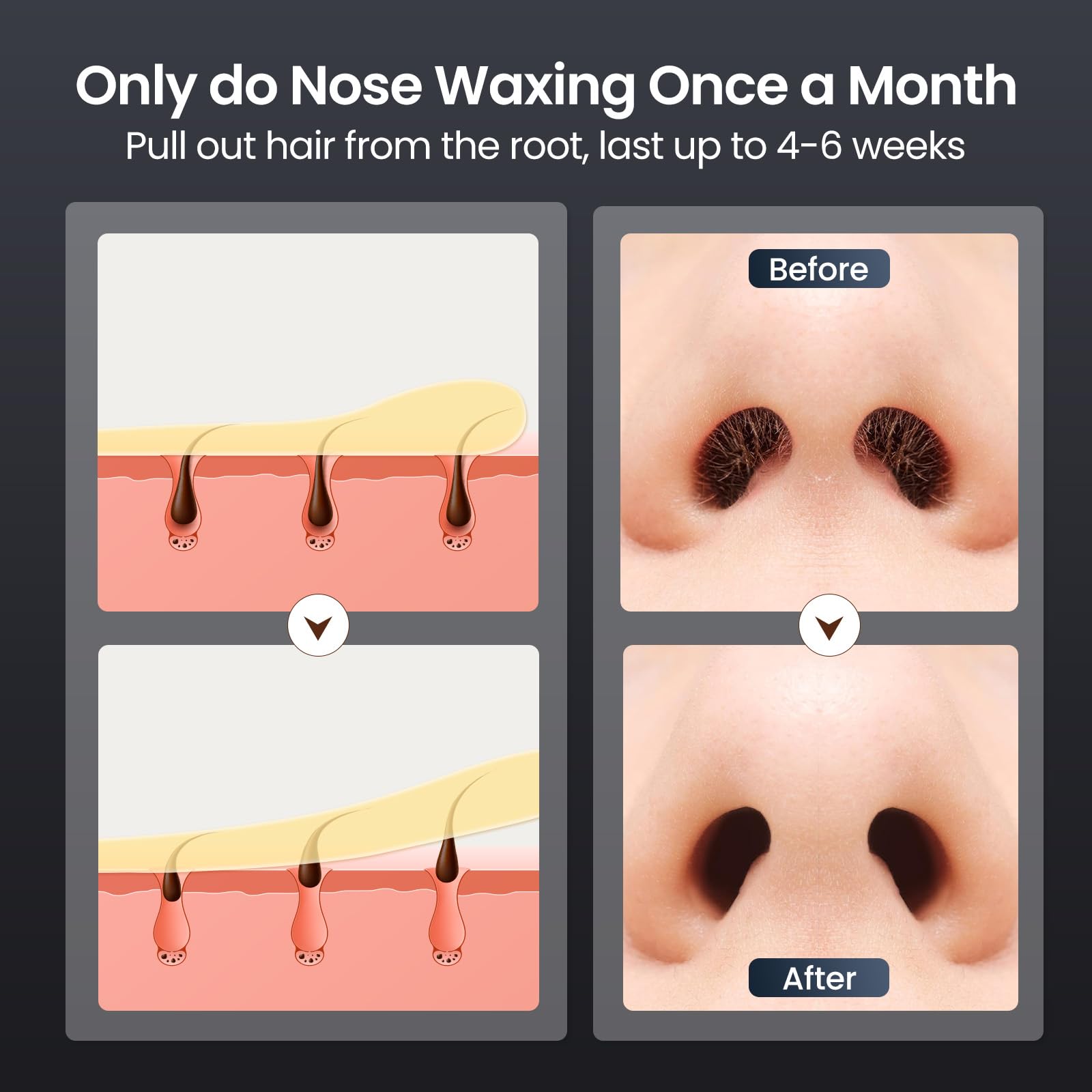 CAVSTORM nose wax kit 20-session kit for long-term use.