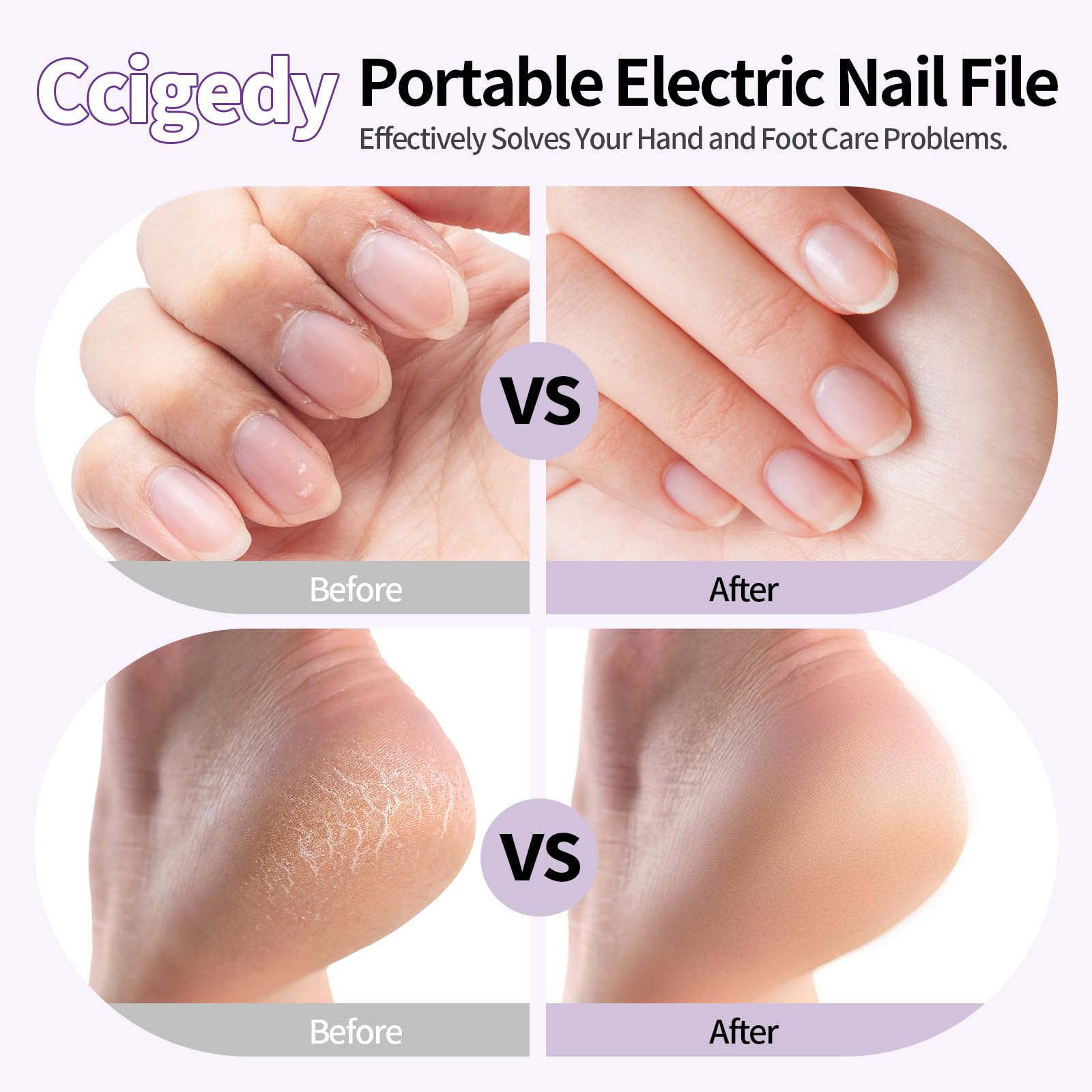Ccigedy 8-in-1 salon kit with diamond bits for cuticle and callus care