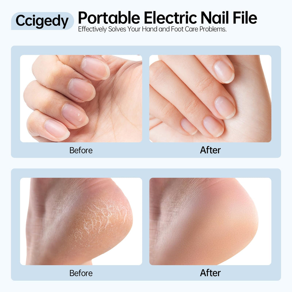 Ccigedy nail drill set with 6 bits ready for shaping, polishing, and removal.