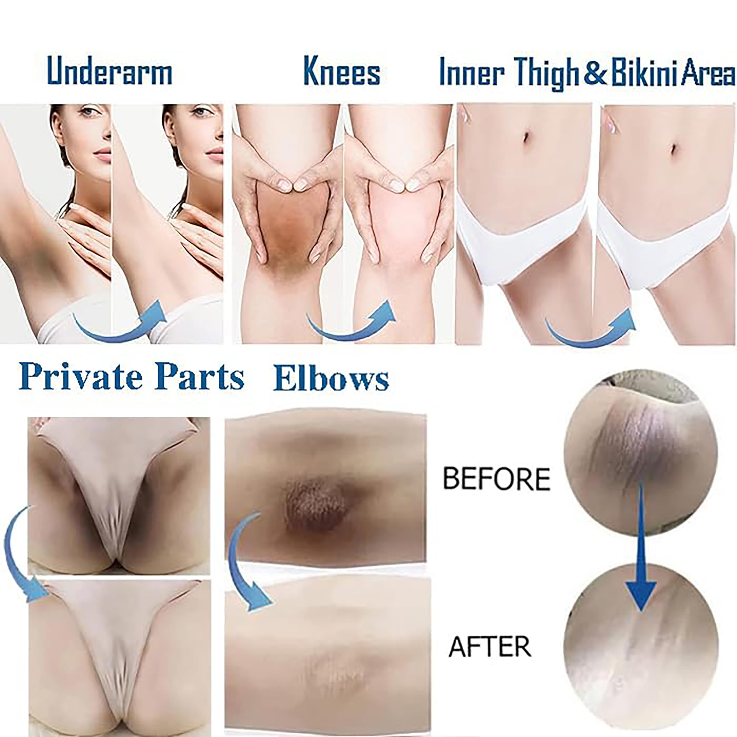 Ceavo armpit-bleaching-cream underarm use delivers gentle brightening with a soothing scent.