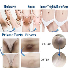 Ceavo armpit-bleaching-cream underarm use delivers gentle brightening with a soothing scent.