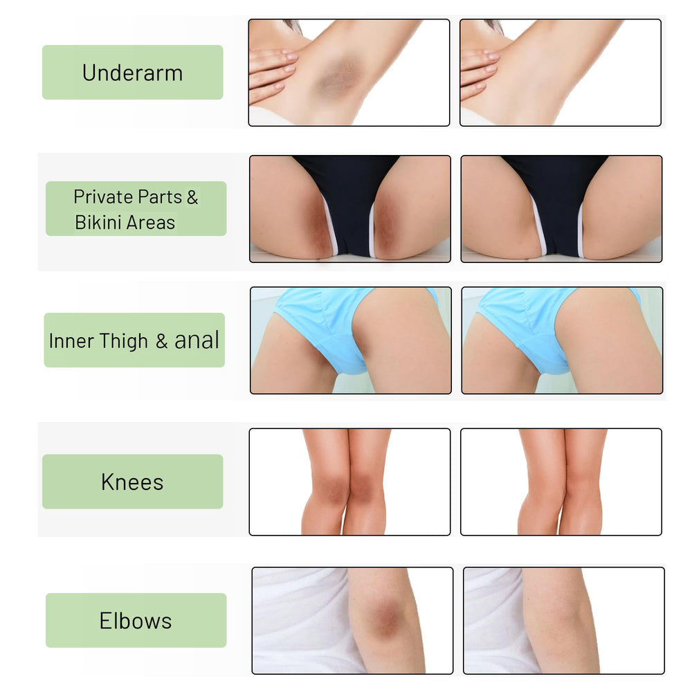 Ceavo Skin Whitening Cream bikini line brightening and uniform look.