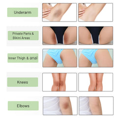 Ceavo Skin Whitening Cream bikini line brightening and uniform look.