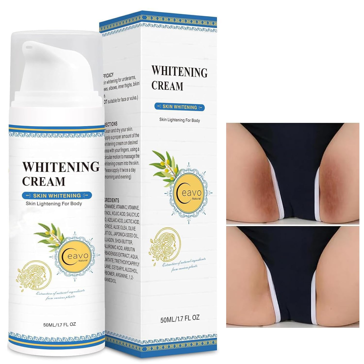 Ceavo Skin Whitening Cream bottle front shows gentle formula for smoother skin