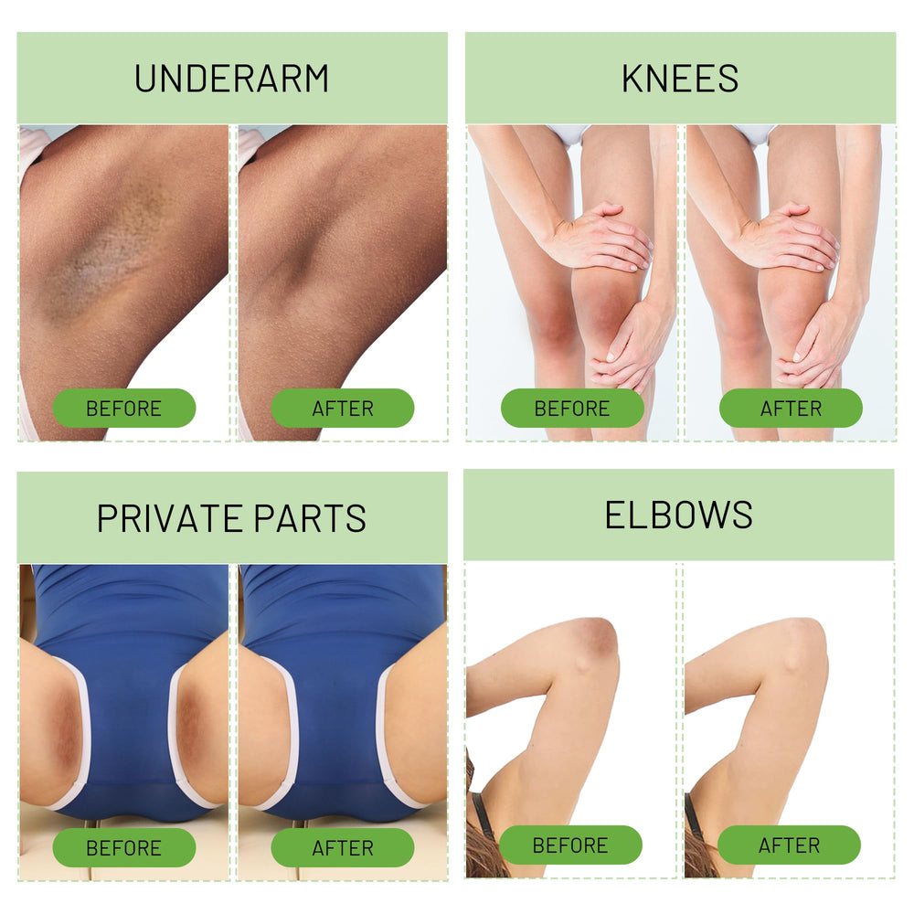 Ceavo Skin Whitening Cream inner thigh for smooth, even color.