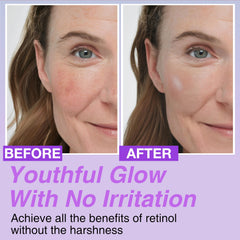 Drops blending with moisturizer demonstrates customizable anti-aging routine for CELDYQUE Bakuchiol.