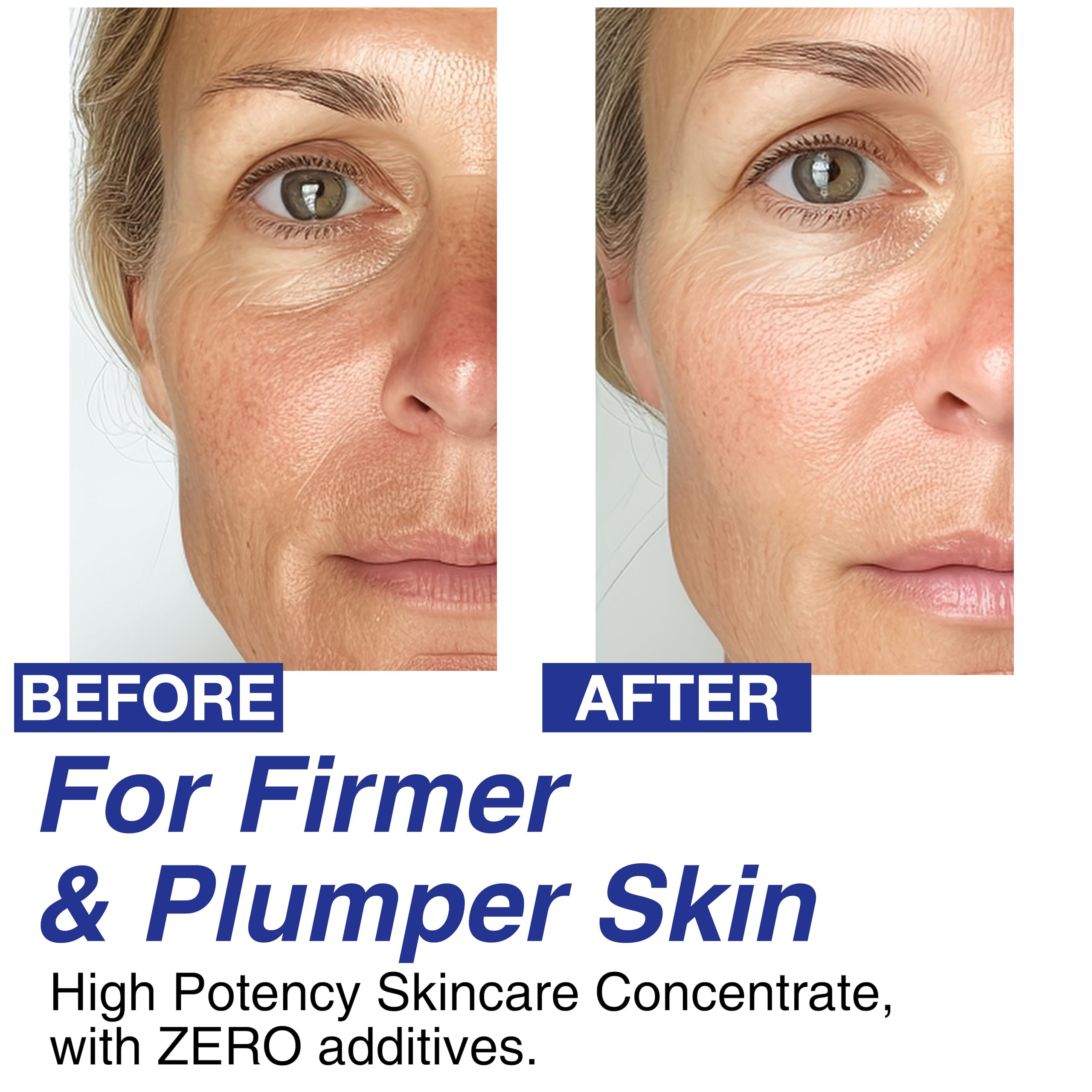 CELDYQUE Volufiline jawline contouring action hints at sharper definition.