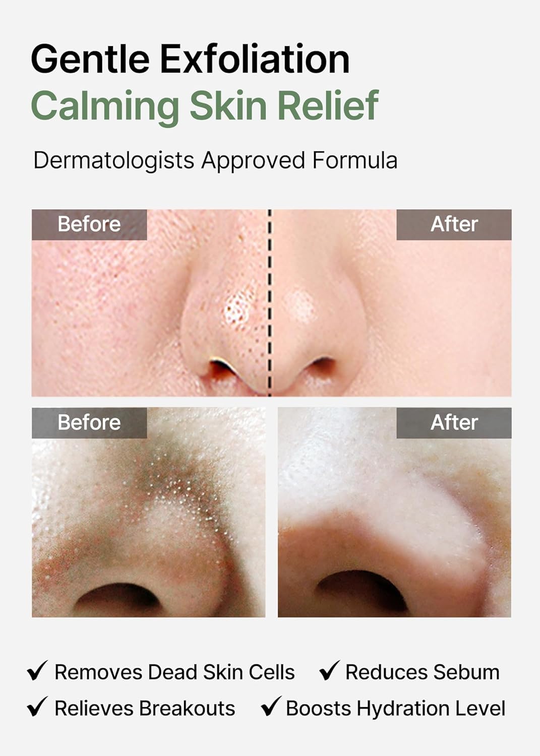 Celimax Ji.Woo.Gae gauze side close-up highlights targeted pore cleansing