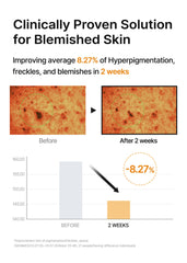 Celimax Pore+Dark Spot Brightening Pad with hyaluronic acid supports hydrated skin during routine