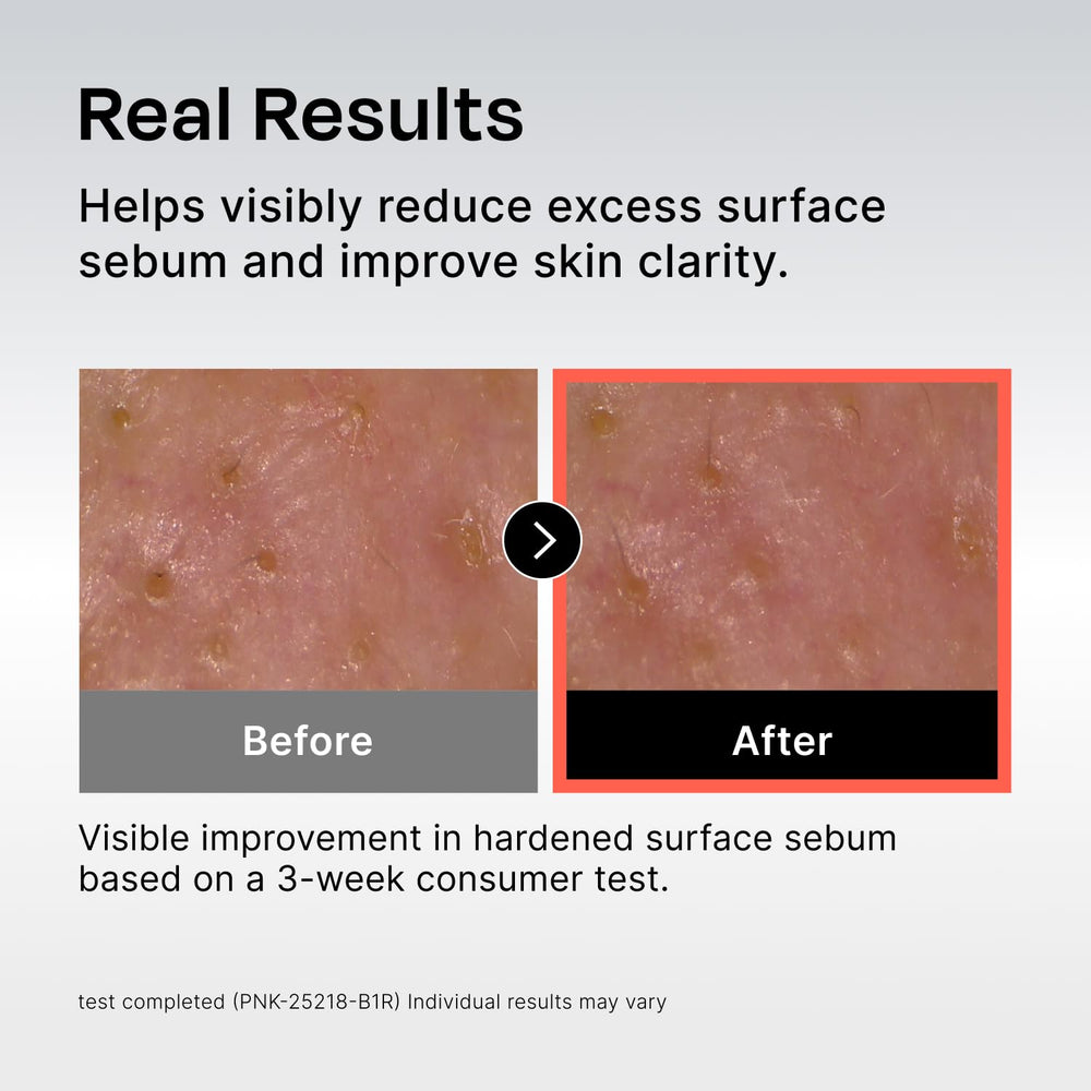 Application motion on clean skin demonstrates gentle patting technique