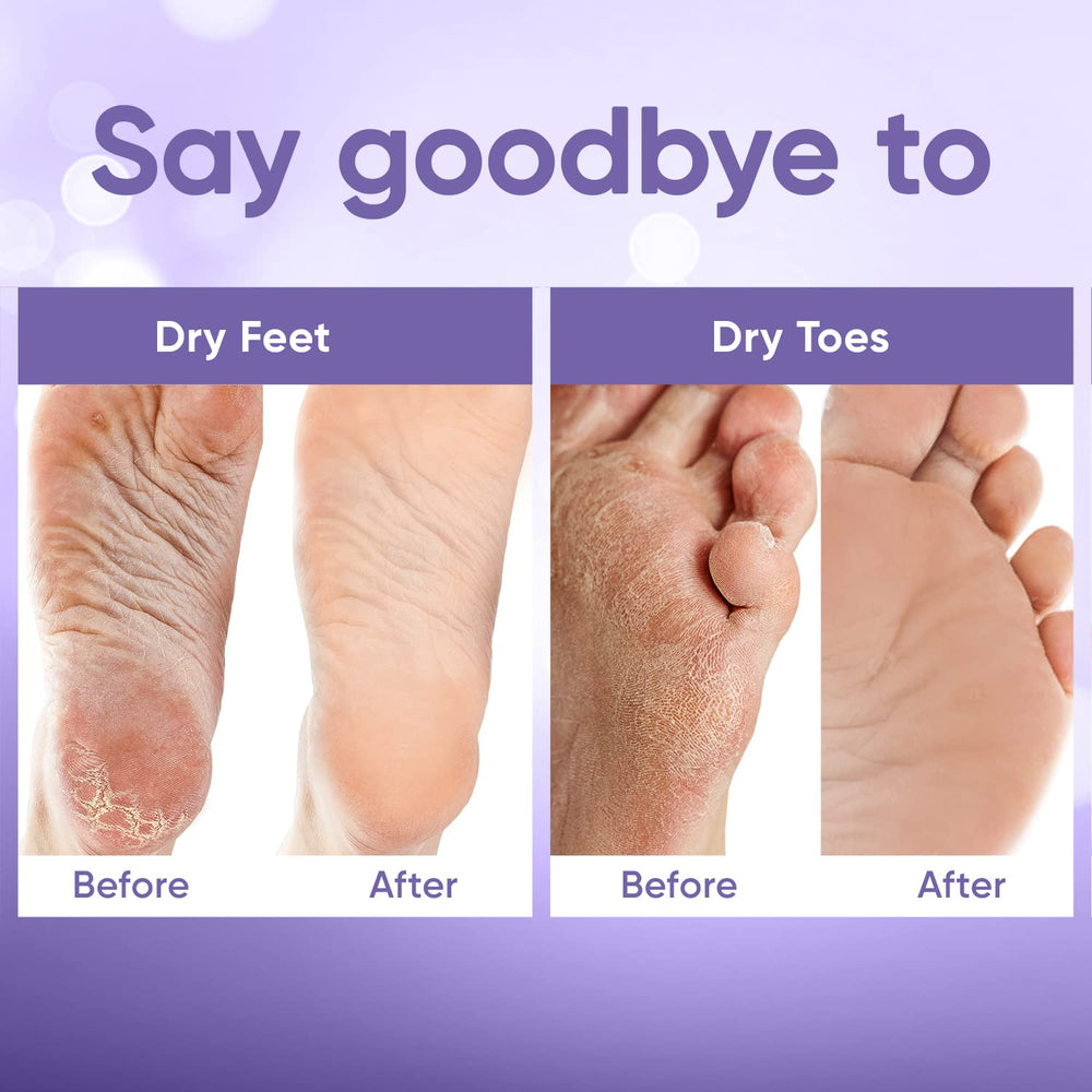 CÉLOR Foot Peel Mask aloe vera ingredients nourish dry skin during the treatment.