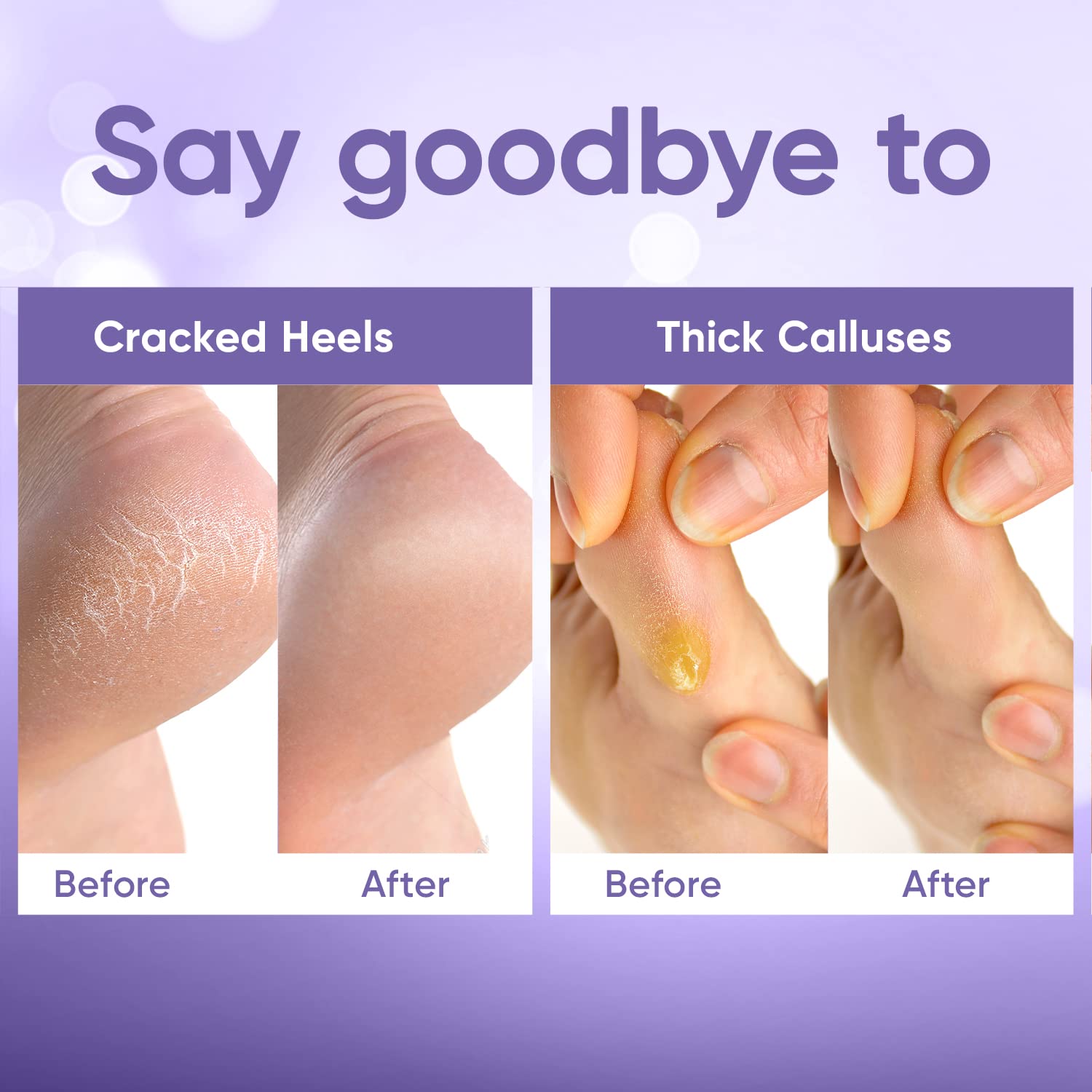 CÉLOR Foot Peel Mask at-home spa use reveals baby-soft feet over time.
