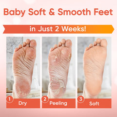 CÉLOR Foot Peel Mask booties on feet show easy at-home exfoliation for smoother skin.